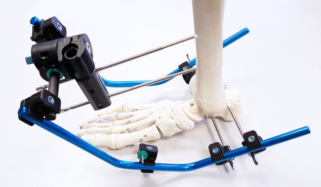 Gexfoot fixateur pour pied
